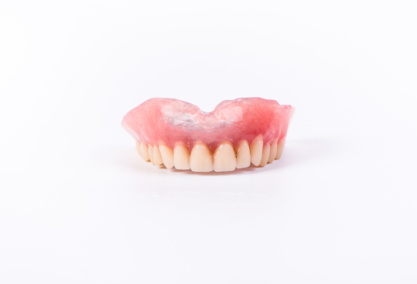 Things To Know About Implant Supported Dentures